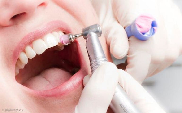 Why More People Prefer Dental Implants For Their Missing Natural Teeth?