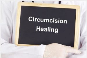 Circumcision Method