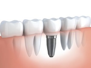 Dental Teeth
