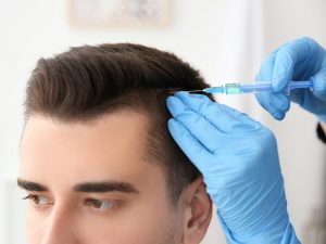 PRP Hair Loss