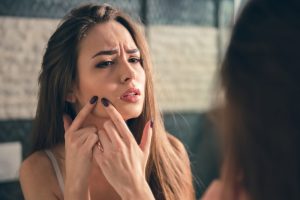 Get Rid Of Pimples Permanently