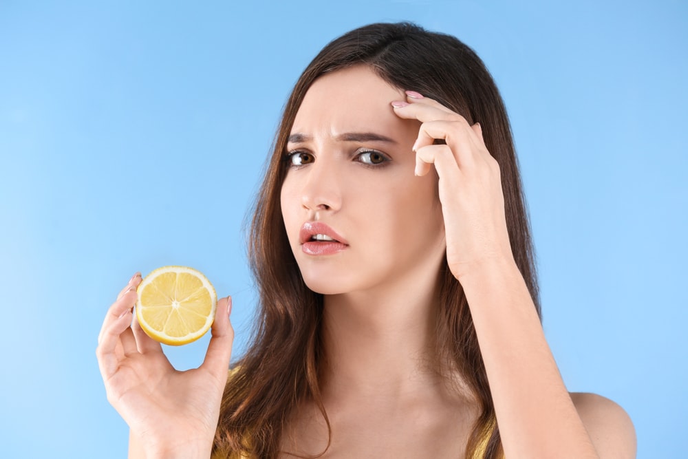 lemon for pimples