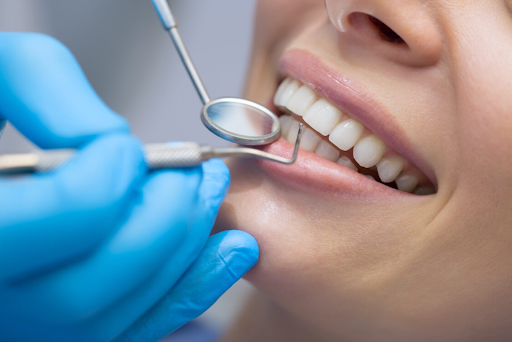 Unlocking the Benefits of Orthodontics
