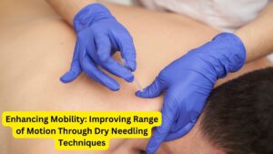 Enhancing Mobility: Improving Range of Motion Through Dry Needling Techniques