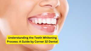 Understanding the Teeth Whitening Process A Guide by Corner 32 Dental