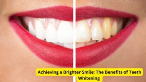 Achieving a Brighter Smile: The Benefits of Teeth Whitening