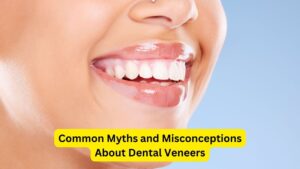 Common Myths and Misconceptions About Dental Veneers