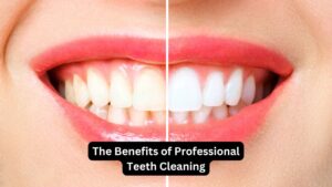 Professional Teeth Cleaning