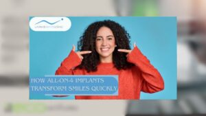 How All-On-4 Implants Transform Smiles Quickly