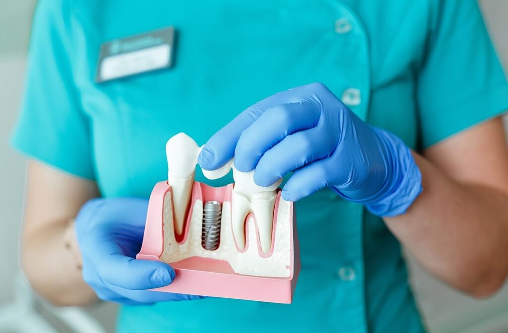 Dental-Implants-by-a-Skilled-Dentist
