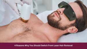 4 Reasons Why You Should Switch From Laser Hair Removal