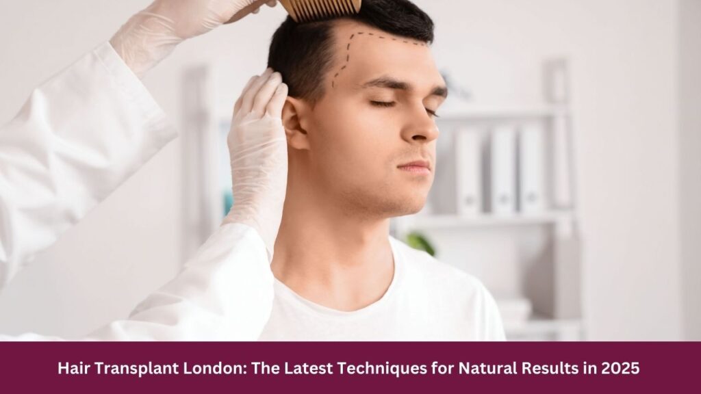 Hair Transplant London: The Latest Techniques for Natural Results in 2025
