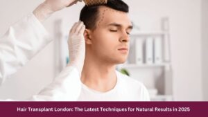 Hair Transplant London: The Latest Techniques for Natural Results in 2025