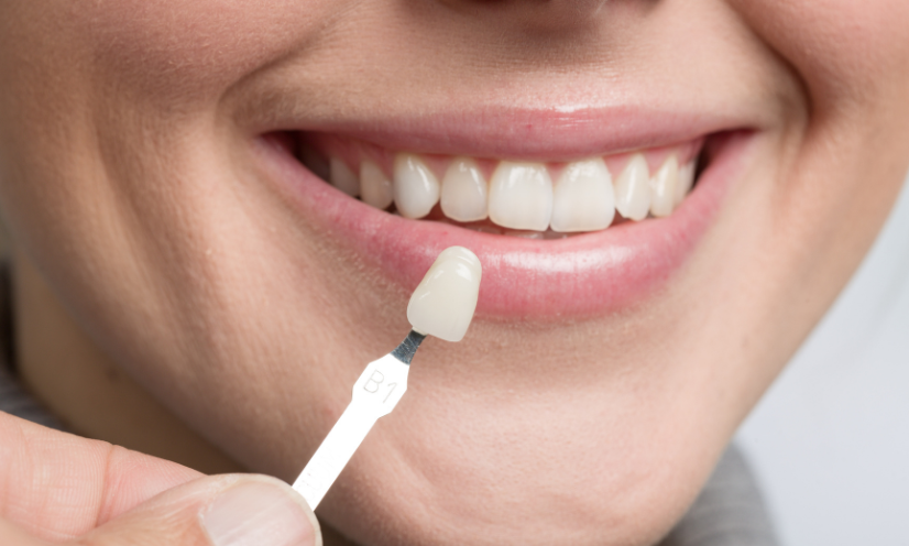 family dentistry