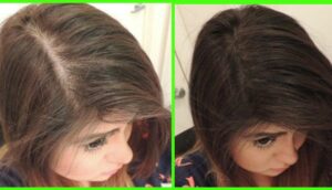 hair-growth-supplements