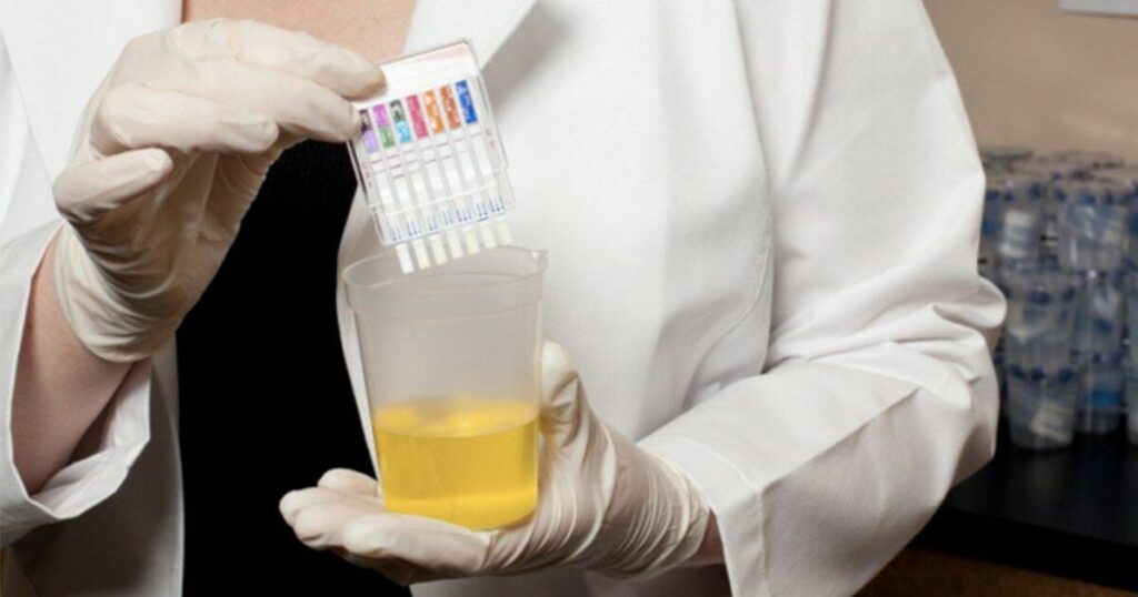 workplace-drug-testing-kits