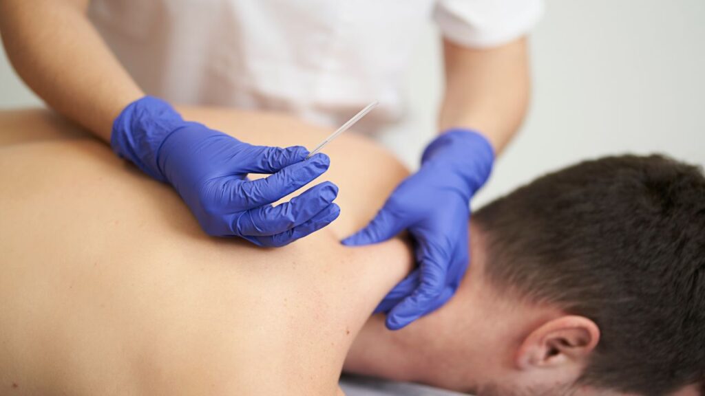 Dry Needling Benefits