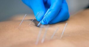 Dry Needling Solutions