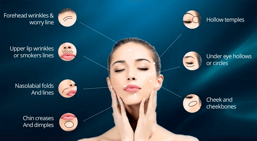 Dermal Fillers Phoenix