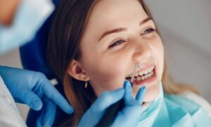 teeth straightening benefits
