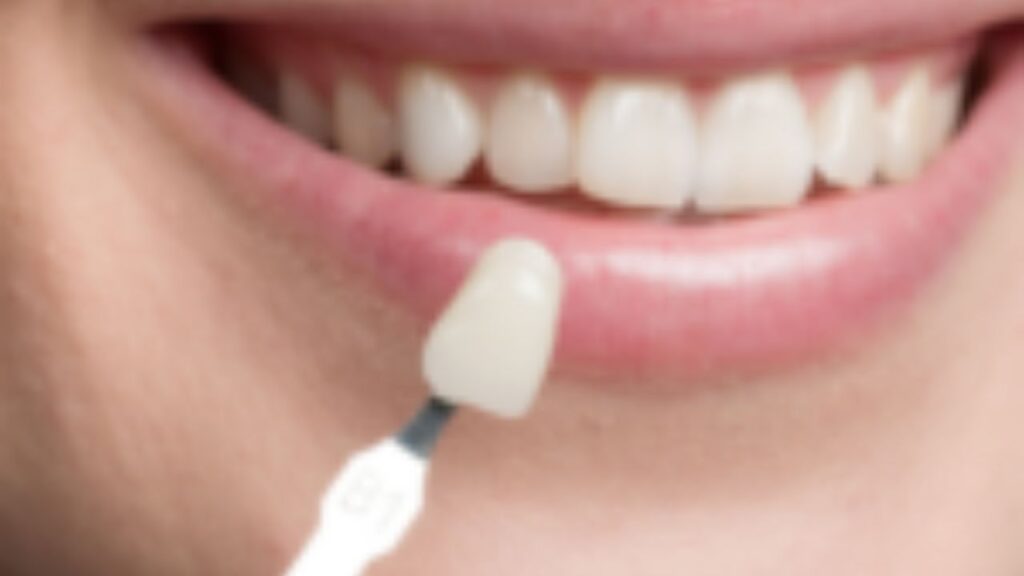 family dentistry