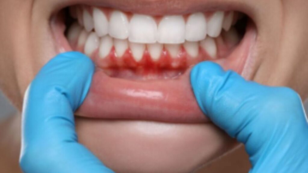 periodontal disease and overall health