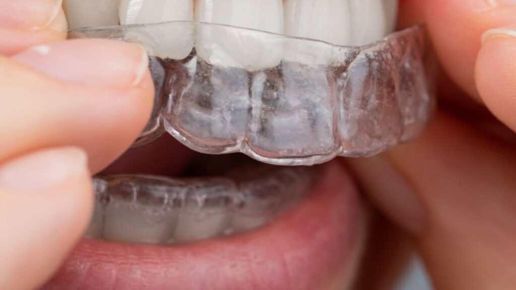 straighten teeth at home