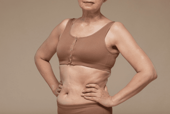 Qualifies You for a Mini Tummy Tuck