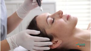 average-price-of-a-microneedling-session